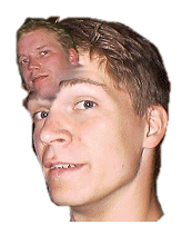 En kvise i panna er &aring; forakte